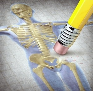 csontritkulas-cikk-blog